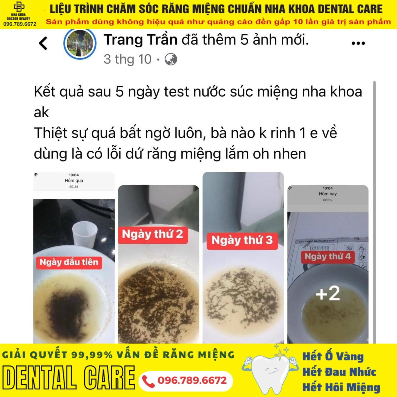 nuoc suc mieng dental care 3 min