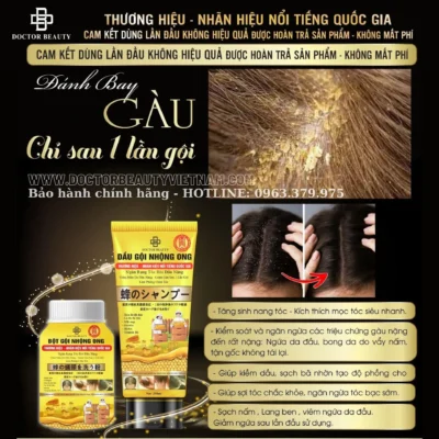 nhộng ong bộ 2 hết gàu nấm ngứa da đầu
